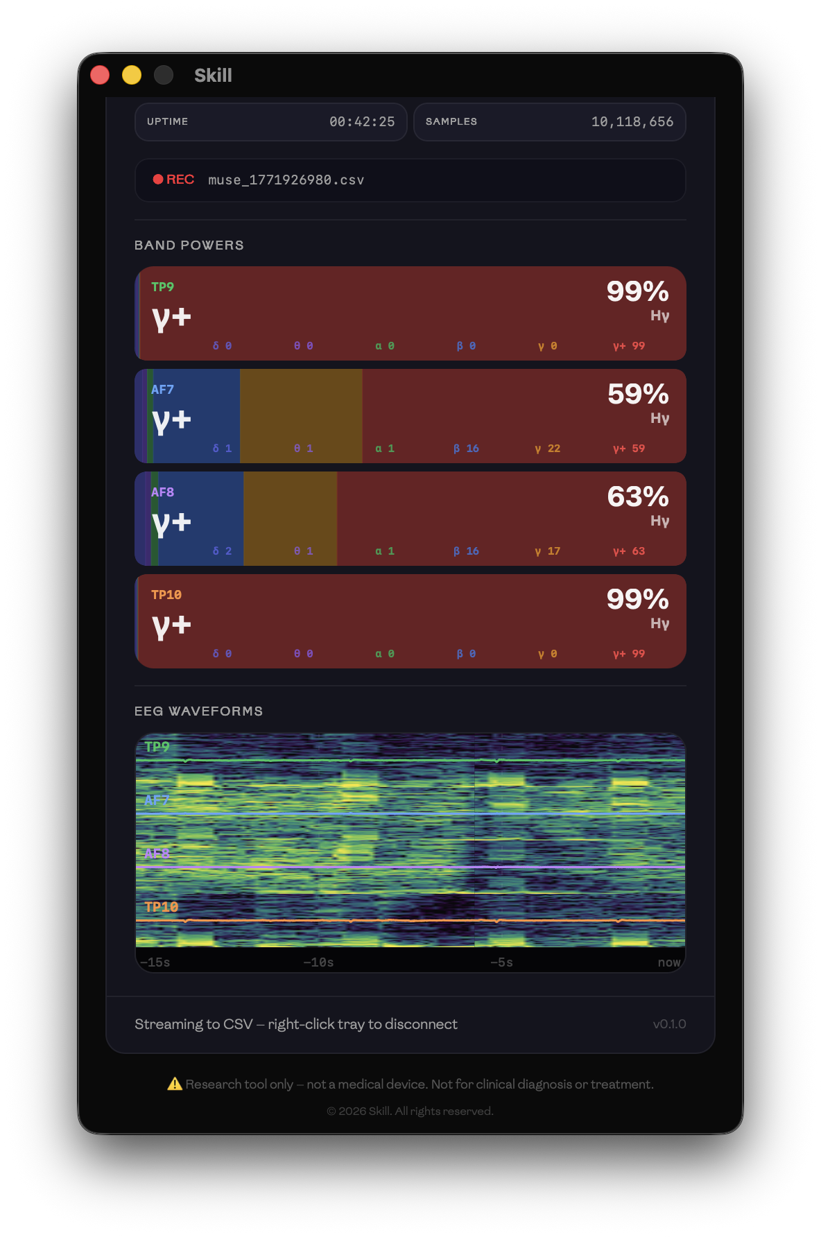 Dashboard — per-channel band powers and EEG spectrograms