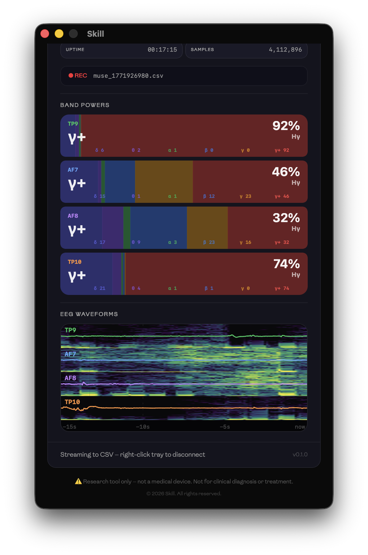 Dashboard — per-channel band power bars and EEG waveforms with spectrograms
